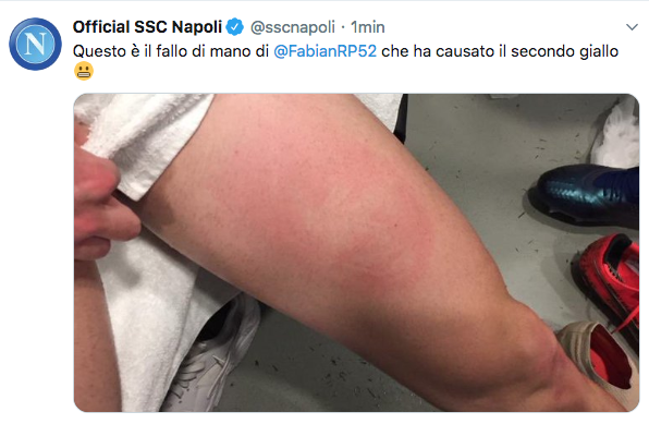 Il Napoli protesta: «Questo il fallo di mano di Fabian Ruiz»